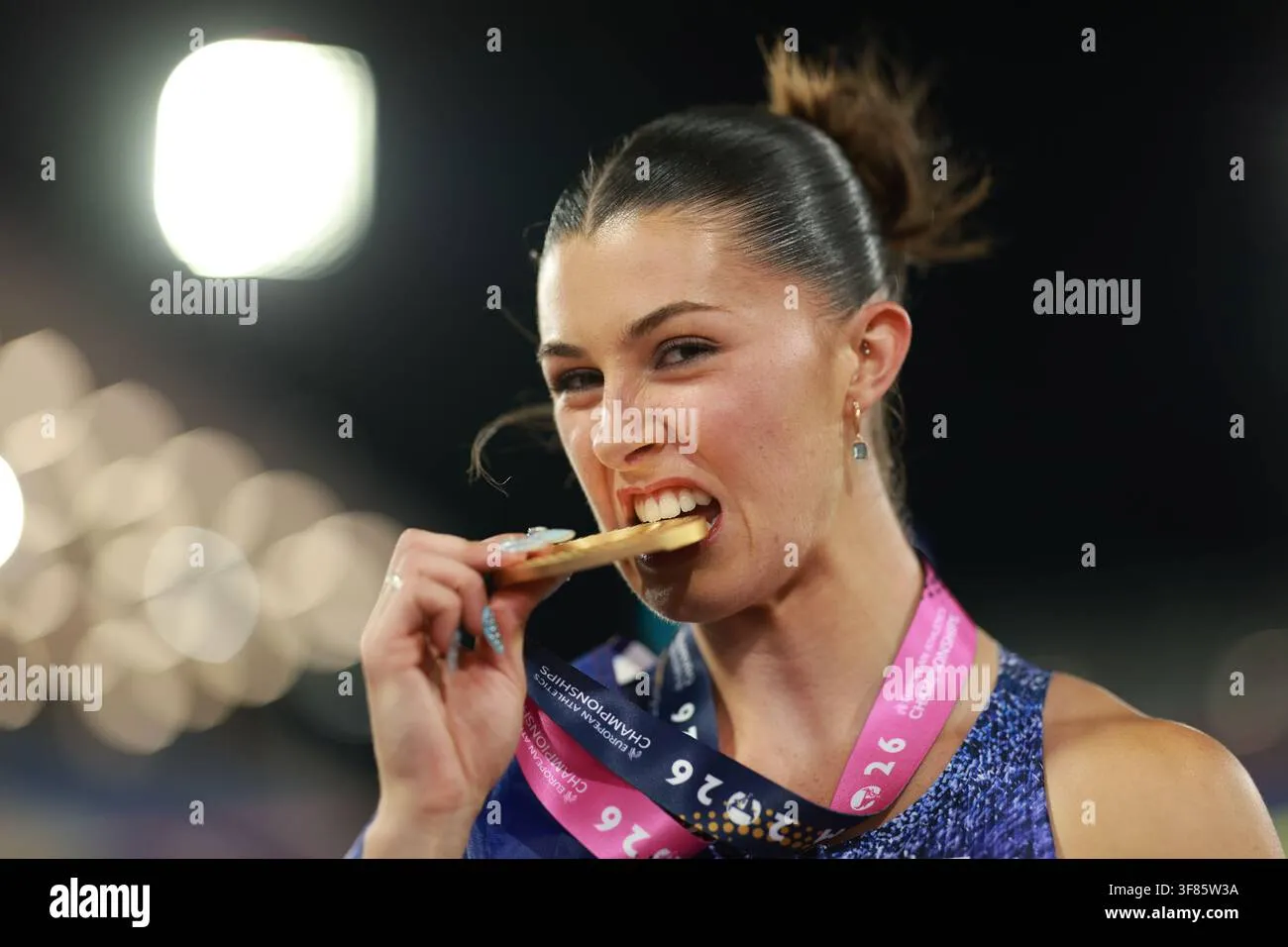 Medal and metal edges stay sharp after cleanup — before editing